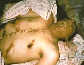 شريط يظهر تعذيب فلسطيني وسرقة أعضائه  صورة رقم 1