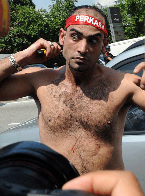  فلسطيني شطب جسده محتجا على مهاجمة اسطول الحرية!  صورة رقم 10