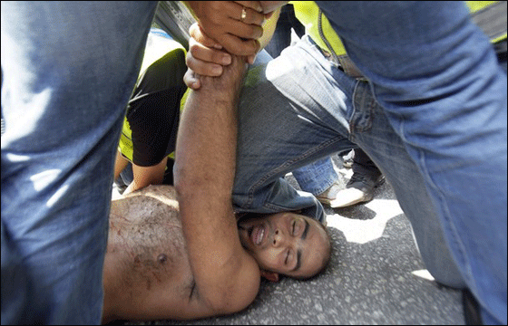  فلسطيني شطب جسده محتجا على مهاجمة اسطول الحرية!  صورة رقم 13