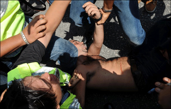  فلسطيني شطب جسده محتجا على مهاجمة اسطول الحرية!  صورة رقم 14