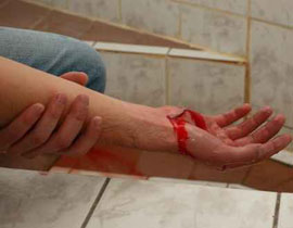 الجلد والسجن لسعودي قطع يد شقيقته وطعن زوجها! صورة رقم 1