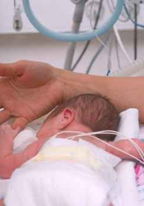 ولادتان غريبتان في سوريا احداهما مولود بلا فم وبعين واحدة! صورة رقم 2