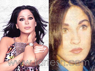 فضائح الصور: الفنانات قبل وبعد عمليات التجميل!  صورة رقم 18