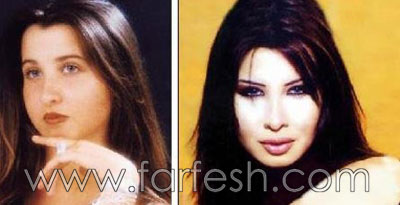 فضائح الصور: الفنانات قبل وبعد عمليات التجميل!  صورة رقم 11