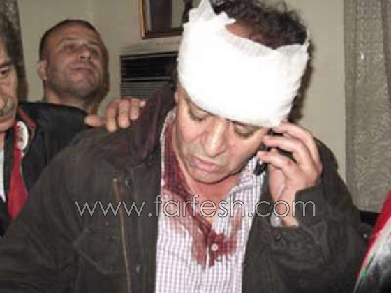 فنانون سوريون يتعرضون للضرب والهجوم في القاهرة!!   صورة رقم 3