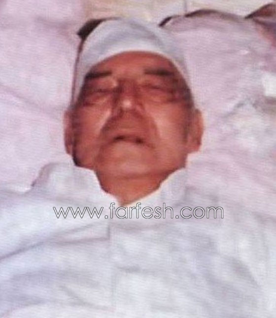 صور الفنانين في اللحظات الأخيرة وهم على فراش الموت صورة رقم 7