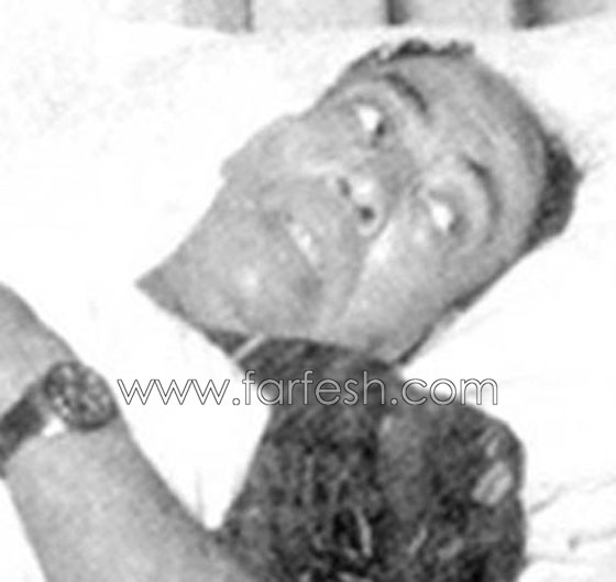 صور الفنانين في اللحظات الأخيرة وهم على فراش الموت صورة رقم 13