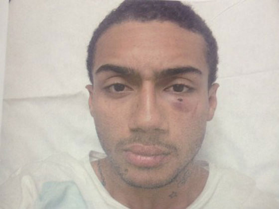 جاستين بيبر يدفع ثمن اعتداء حراسه الشخصيين على شاب في ملهى صورة رقم 6