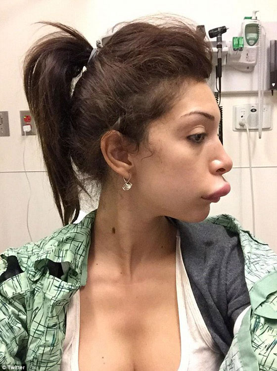 بالصور..عملية تجميل لنجمة امريكية تنتهي بغرفة الطوارئ صورة رقم 1