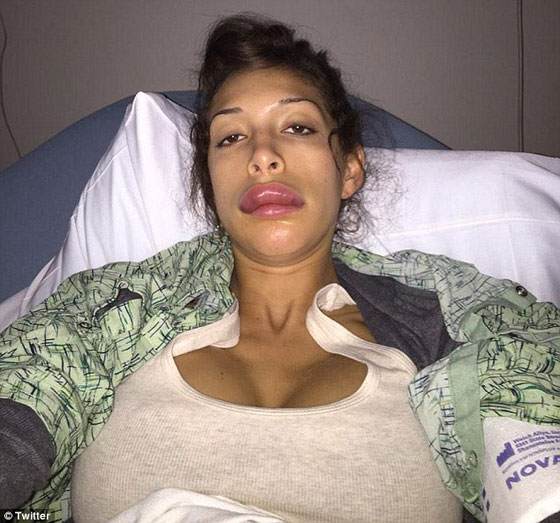 بالصور..عملية تجميل لنجمة امريكية تنتهي بغرفة الطوارئ صورة رقم 2