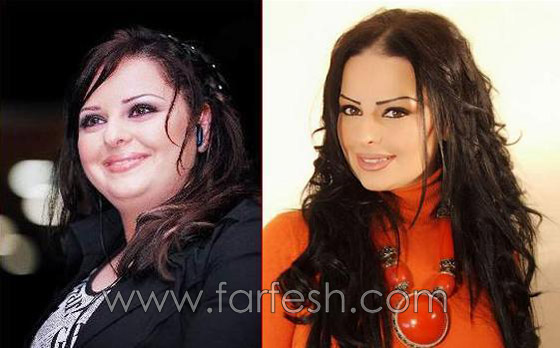 صور فنانين عرب قبل وبعد ريجيم تخفيف الوزن.. لن تصدّق الفرق! صورة رقم 3 صور فنانين عرب قبل وبعد ريجيم تخفيف الوزن.. لن تصدّق الفرق! صورة رقم 3
