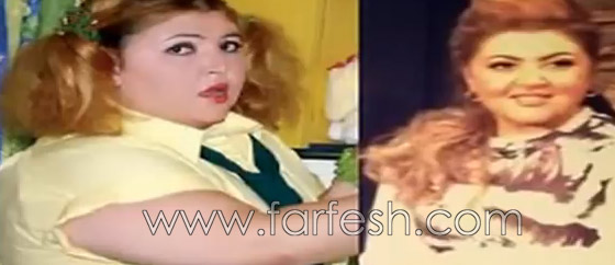 صور فنانين عرب قبل وبعد ريجيم تخفيف الوزن.. لن تصدّق الفرق! صورة رقم 5 صور فنانين عرب قبل وبعد ريجيم تخفيف الوزن.. لن تصدّق الفرق! صورة رقم 5