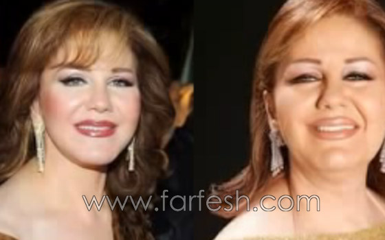 صور فنانين عرب قبل وبعد ريجيم تخفيف الوزن.. لن تصدّق الفرق! صورة رقم 6 صور فنانين عرب قبل وبعد ريجيم تخفيف الوزن.. لن تصدّق الفرق! صورة رقم 6