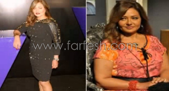 صور فنانين عرب قبل وبعد ريجيم تخفيف الوزن.. لن تصدّق الفرق! صورة رقم 8 صور فنانين عرب قبل وبعد ريجيم تخفيف الوزن.. لن تصدّق الفرق! صورة رقم 8