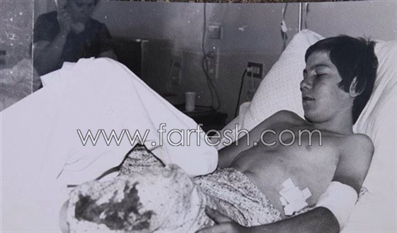صورة علي جابر بعمر 13 عاما وهو جريح اثناء هجوم اسرائيلي على لبنان صورة رقم 1