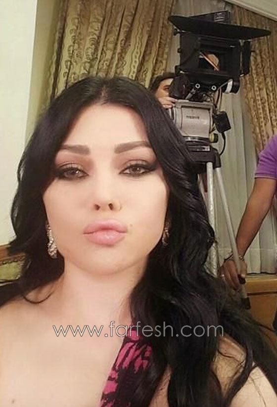 مسلسلات رمضان: صور الفنانات يتسابقن لشد الوجه، تكبير الشفاه ونفخ الوجنتين! صورة رقم 3 مسلسلات رمضان: صور الفنانات يتسابقن لشد الوجه، تكبير الشفاه ونفخ الوجنتين! صورة رقم 3