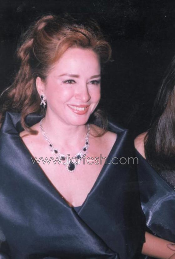 الفنانة نجلاء فتحي في حالة صحية سيئة والتهاب في الكبد أثناء علاجها من الصدفية صورة رقم 4 الفنانة نجلاء فتحي في حالة صحية سيئة والتهاب في الكبد أثناء علاجها من الصدفية صورة رقم 4