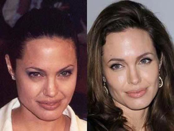 صور فنانات قبل وبعد البوتوكس تؤكد عودة شبابهن وجمالهن واختفاء تجاعيد الوجه صورة رقم 14 صور فنانات قبل وبعد البوتوكس تؤكد عودة شبابهن وجمالهن واختفاء تجاعيد الوجه صورة رقم 14