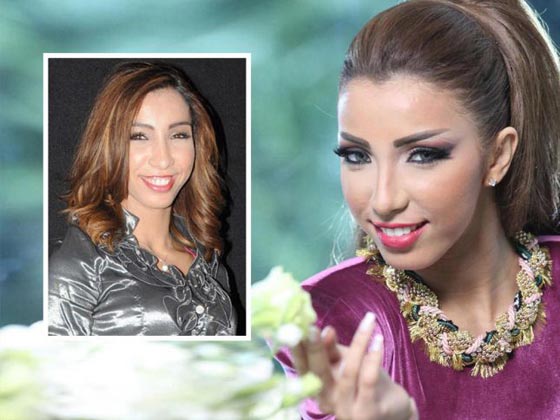 صور دينا بطمة توضّح ما فعلته بها عمليات التجميل صورة رقم 1 صور دينا بطمة توضّح ما فعلته بها عمليات التجميل صورة رقم 1