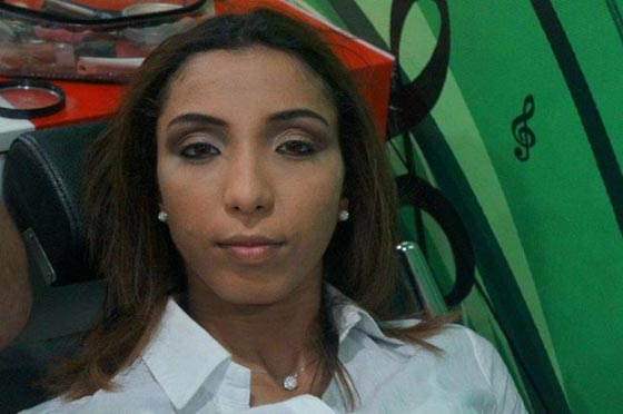 صور دينا بطمة توضّح ما فعلته بها عمليات التجميل صورة رقم 3 صور دينا بطمة توضّح ما فعلته بها عمليات التجميل صورة رقم 3