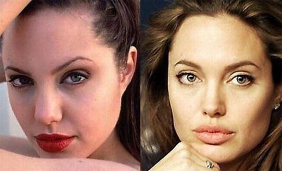 صور انوف نجمات هوليوود قبل عمليات التجميل وبعدها صورة رقم 23 صور انوف نجمات هوليوود قبل عمليات التجميل وبعدها صورة رقم 23