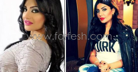 صور امل العوضي قبل وبعد اجراء 7 عمليات تجميل! صورة رقم 1 صور امل العوضي قبل وبعد اجراء 7 عمليات تجميل! صورة رقم 1