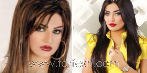 Mosalsalatpro Com Ù…ÙˆÙ‚Ø¹ Ù…Ø³Ù„Ø³Ù„Ø§Øª ØµÙˆØ± Ø§Ù…Ù„ Ø§Ù„Ø¹ÙˆØ¶ÙŠ Ù‚Ø¨Ù„ ÙˆØ¨Ø¹Ø¯ Ø§Ø¬Ø±Ø§Ø¡ 7 Ø¹Ù…Ù„ÙŠØ§Øª ØªØ¬Ù…ÙŠÙ„