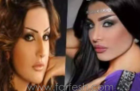 صور امل العوضي قبل وبعد اجراء 7 عمليات تجميل! صورة رقم 4 صور امل العوضي قبل وبعد اجراء 7 عمليات تجميل! صورة رقم 4