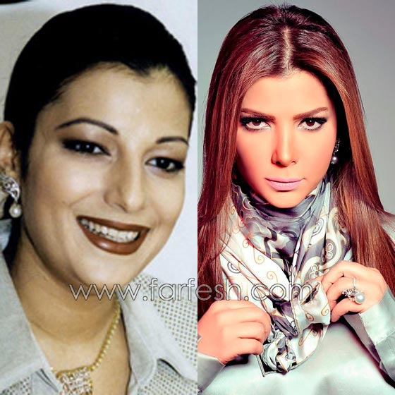صور فنانات عربيات قبل وبعد الشهرة: صرن اجمل مع تقدم العمر صورة رقم 5 صور فنانات عربيات قبل وبعد الشهرة: صرن اجمل مع تقدم العمر صورة رقم 5