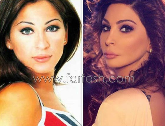 صور فنانات عربيات قبل وبعد الشهرة: صرن اجمل مع تقدم العمر صورة رقم 6 صور فنانات عربيات قبل وبعد الشهرة: صرن اجمل مع تقدم العمر صورة رقم 6