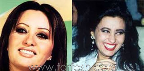 صور فنانين وفنانات اختلفت ملامحهم كليا بعد عمليات تجميل اسنانهم صورة رقم 5 صور فنانين وفنانات اختلفت ملامحهم كليا بعد عمليات تجميل اسنانهم صورة رقم 5