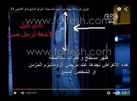 جمهور ستار اكاديمي 11 ينشر صور وفيديو سقوط سهيلة بن لشهب ويثبت انه مفبرك! صورة رقم 5 جمهور ستار اكاديمي 11 ينشر صور وفيديو سقوط سهيلة بن لشهب ويثبت انه مفبرك! صورة رقم 5