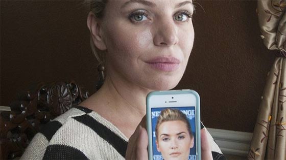 صور اشهر 10 عمليات تجميل لمعجبين ارادوا التشبه بالمشاهير صورة رقم 8 صور اشهر 10 عمليات تجميل لمعجبين ارادوا التشبه بالمشاهير صورة رقم 8