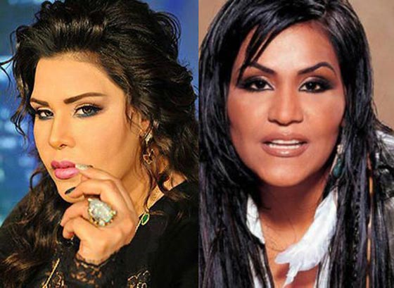 فيديو فنانات ينكرن اجراء عمليات تجميل، بينما صور (قبل وبعد) تفضح كذبهن! صورة رقم 7 فيديو فنانات ينكرن اجراء عمليات تجميل، بينما صور (قبل وبعد) تفضح كذبهن! صورة رقم 7