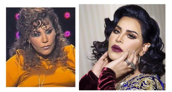 فيديو فنانات ينكرن اجراء عمليات تجميل، بينما صور (قبل وبعد) تفضح كذبهن! صورة رقم 6 فيديو فنانات ينكرن اجراء عمليات تجميل، بينما صور (قبل وبعد) تفضح كذبهن! صورة رقم 6
