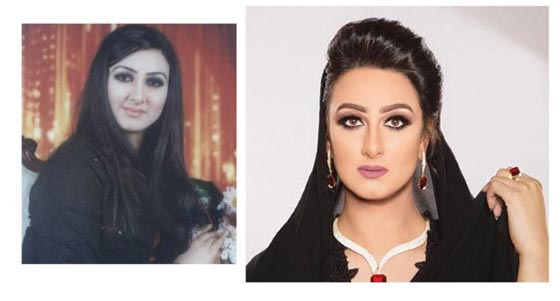 فيديو فنانات ينكرن اجراء عمليات تجميل، بينما صور (قبل وبعد) تفضح كذبهن! صورة رقم 3 فيديو فنانات ينكرن اجراء عمليات تجميل، بينما صور (قبل وبعد) تفضح كذبهن! صورة رقم 3