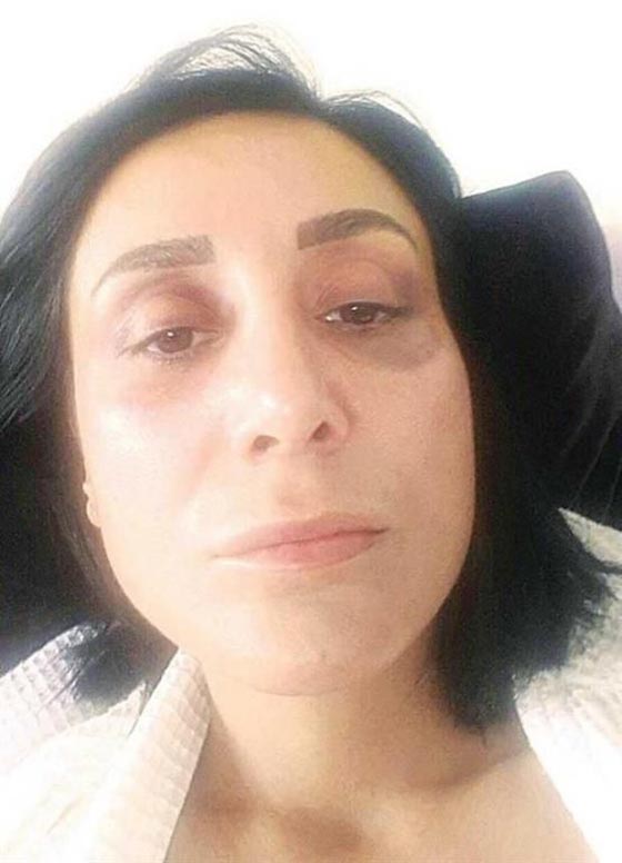 ساروهان.. التركي الاسمر فاتن الحسناوات يدفع ثمنا غاليا لتعنيفه حبيبته صورة رقم 7 ساروهان.. التركي الاسمر فاتن الحسناوات يدفع ثمنا غاليا لتعنيفه حبيبته صورة رقم 7