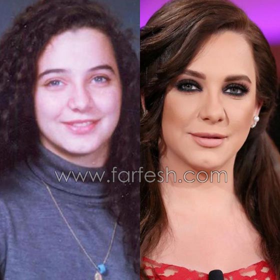 صور فنانين وفنانات بين الماضي والحاضر: هيفاء وهبي ومايا دياب تغيرتا كثيرا، نانسي عجرم كما هي! صورة رقم 6 صور فنانين وفنانات بين الماضي والحاضر: هيفاء وهبي ومايا دياب تغيرتا كثيرا، نانسي عجرم كما هي! صورة رقم 6