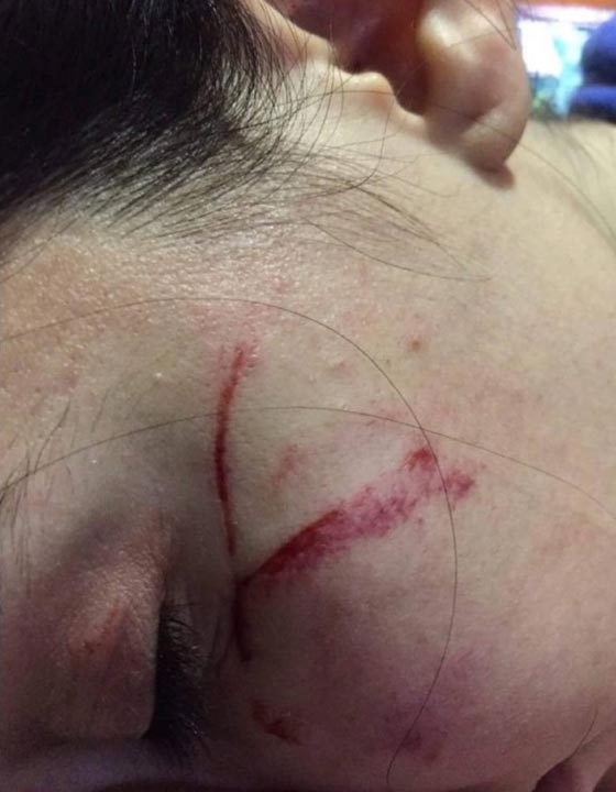 الفنانة اللبنانية قمر في غيبوبة فهل لضعف في القلب او لأن عشيقها اعتدى عليها! صورة رقم 1 الفنانة اللبنانية قمر في غيبوبة فهل لضعف في القلب او لأن عشيقها اعتدى عليها! صورة رقم 1