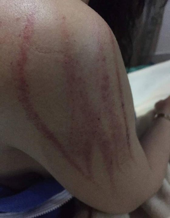 الفنانة اللبنانية قمر في غيبوبة فهل لضعف في القلب او لأن عشيقها اعتدى عليها! صورة رقم 2 الفنانة اللبنانية قمر في غيبوبة فهل لضعف في القلب او لأن عشيقها اعتدى عليها! صورة رقم 2