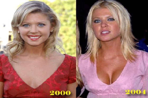 كيف قلبت المخدرات حياة النجمات والمشاهير راسا على عقب؟. صور صورة رقم 11 كيف قلبت المخدرات حياة النجمات والمشاهير راسا على عقب؟. صور صورة رقم 11