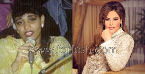 صور فنانين عرب وعالميين قبل وبعد الشهرة.. لن تصدّق الفرق! صورة رقم 17 صور فنانين عرب وعالميين قبل وبعد الشهرة.. لن تصدّق الفرق! صورة رقم 17