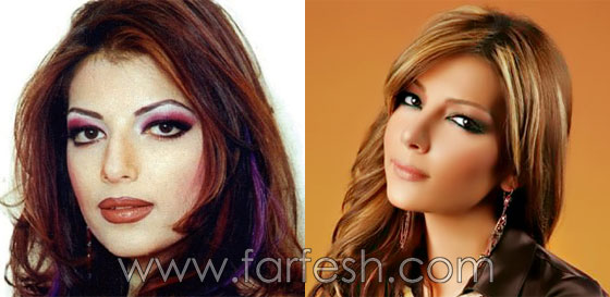 صور فنانين عرب وعالميين قبل وبعد الشهرة.. لن تصدّق الفرق! صورة رقم 19 صور فنانين عرب وعالميين قبل وبعد الشهرة.. لن تصدّق الفرق! صورة رقم 19