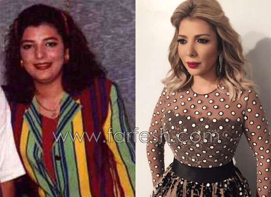 صور فنانين عرب وعالميين قبل وبعد الشهرة.. لن تصدّق الفرق! صورة رقم 18 صور فنانين عرب وعالميين قبل وبعد الشهرة.. لن تصدّق الفرق! صورة رقم 18