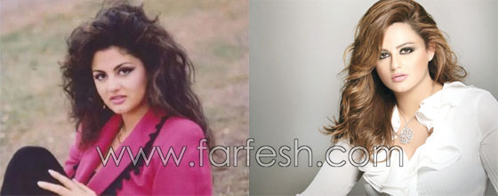 صور فنانين عرب وعالميين قبل وبعد الشهرة.. لن تصدّق الفرق! صورة رقم 21 صور فنانين عرب وعالميين قبل وبعد الشهرة.. لن تصدّق الفرق! صورة رقم 21