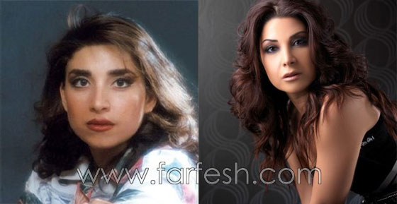 صور فنانين عرب وعالميين قبل وبعد الشهرة.. لن تصدّق الفرق! صورة رقم 26 صور فنانين عرب وعالميين قبل وبعد الشهرة.. لن تصدّق الفرق! صورة رقم 26