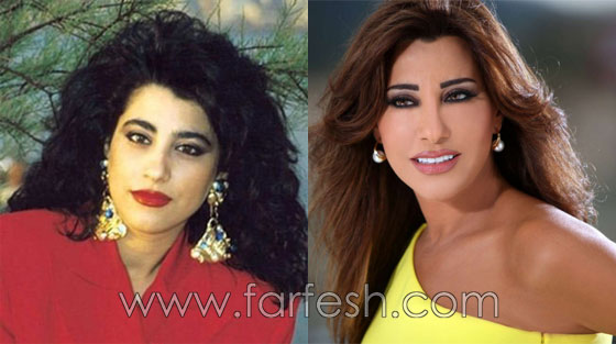 صور فنانين عرب وعالميين قبل وبعد الشهرة.. لن تصدّق الفرق! صورة رقم 27 صور فنانين عرب وعالميين قبل وبعد الشهرة.. لن تصدّق الفرق! صورة رقم 27