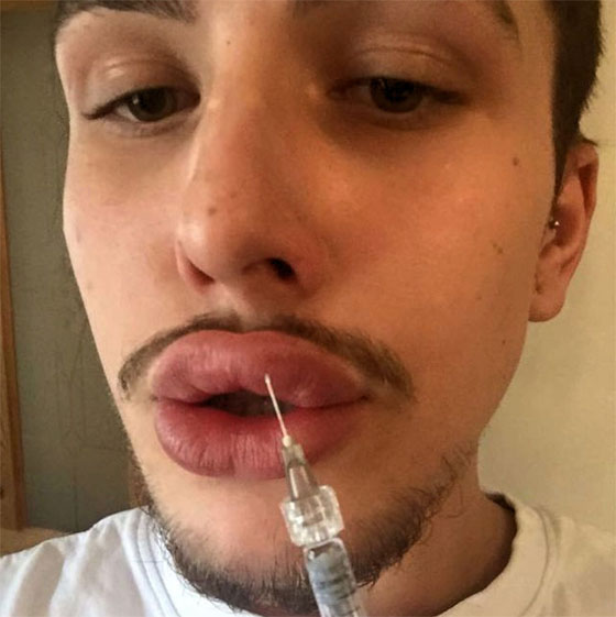 هوس المشاهير.. انفق 21 الف جنيه استرليني للتشبه بكيم كاردشيان صورة رقم 3 هوس المشاهير.. انفق 21 الف جنيه استرليني للتشبه بكيم كاردشيان صورة رقم 3
