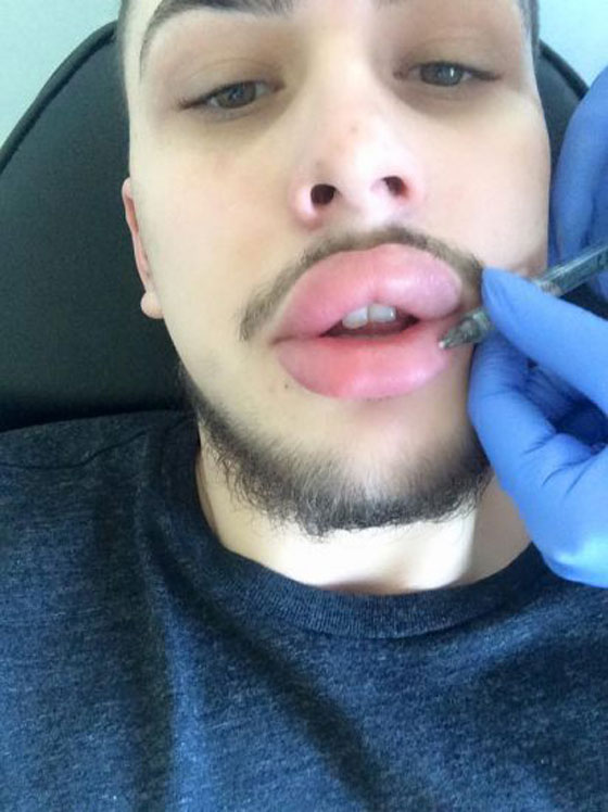هوس المشاهير.. انفق 21 الف جنيه استرليني للتشبه بكيم كاردشيان صورة رقم 2 هوس المشاهير.. انفق 21 الف جنيه استرليني للتشبه بكيم كاردشيان صورة رقم 2