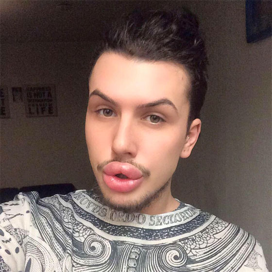 هوس المشاهير.. انفق 21 الف جنيه استرليني للتشبه بكيم كاردشيان صورة رقم 9 هوس المشاهير.. انفق 21 الف جنيه استرليني للتشبه بكيم كاردشيان صورة رقم 9